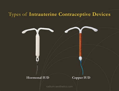 Intrauterine contraception: Candidates and device selection